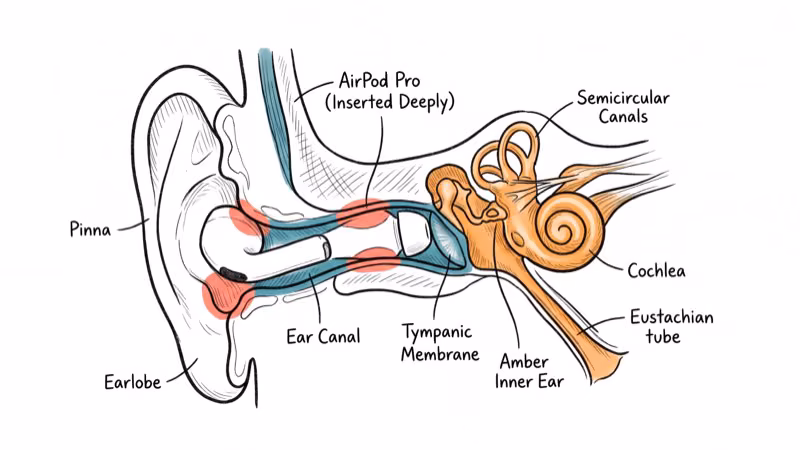 Cross-section of ear canal showing AirPod pressure points against canal walls